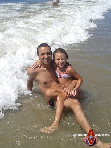 amputado praia
